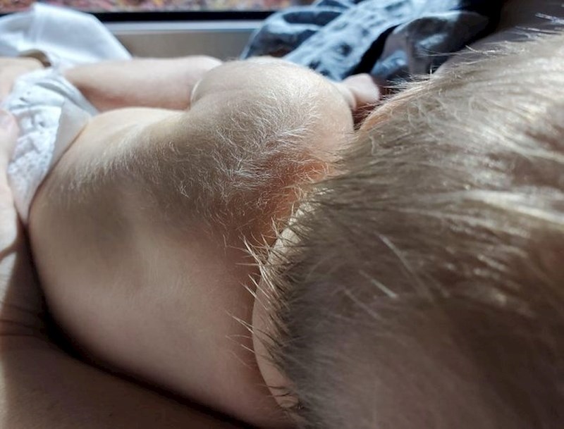 9. Rođen je s "krznom"🥰