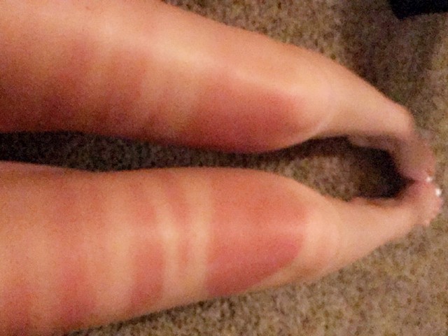11.
