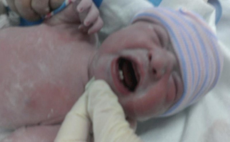 10. Beba se rodila sa zubićima!