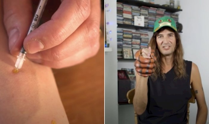 VIDEO Tip već 30 godina dobrovoljno ubrizgava zmijski otrov, objasnio je zašto