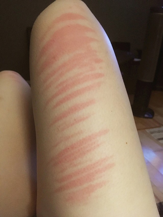 9.