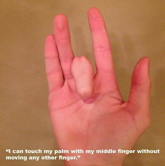 6. Može dodirnuti dlan srednjim prstom bez da pomakne iti jedan drugi