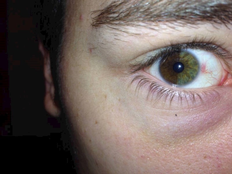 12. "Moj dečko ima stvarno posebne oči!"