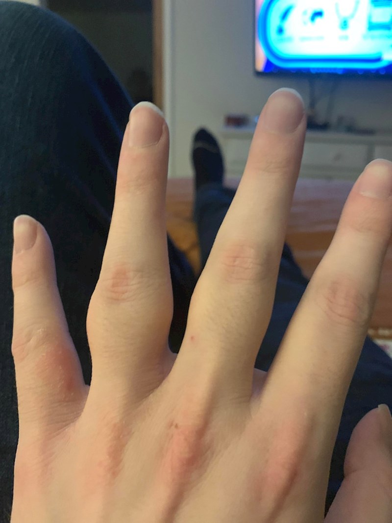 5. Djevojka s debeljuškastim prstima