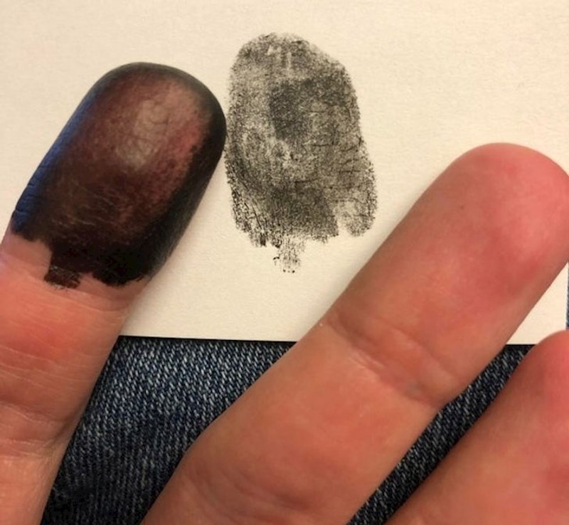 13. "Rođen sam bez otiska prstiju!"