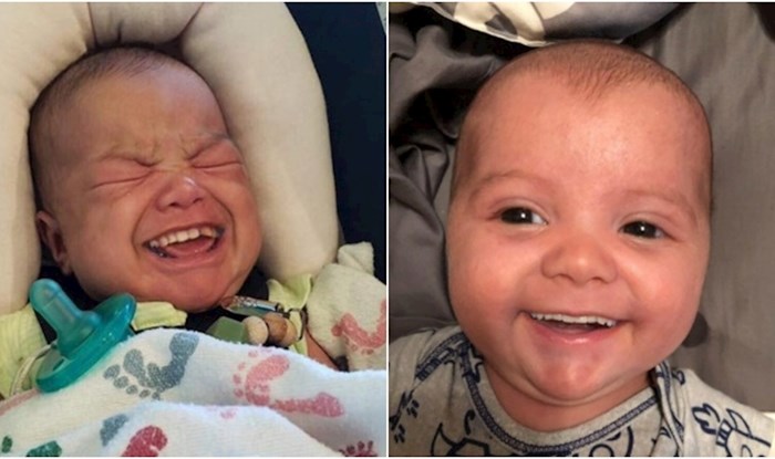 Ljudi masovno fotošopiraju zube na fotke svojih beba, rezultati su istovremeno urnebesni i jezivi