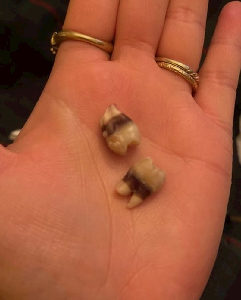 4. Njezini umnjaci imali su prugice