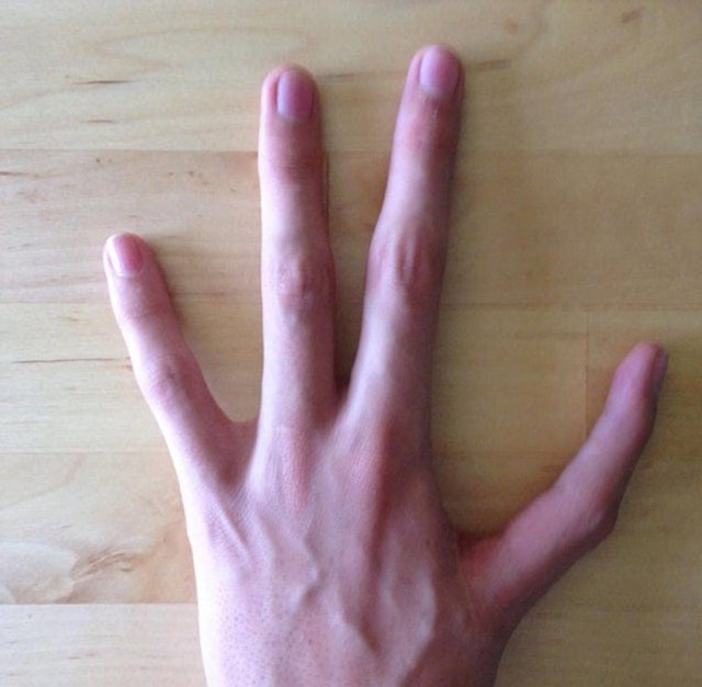 7. Umjesto palca ima kažiprst