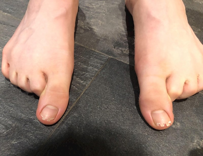 17. Rekla je da si je napravila dvorce od noktiju na nožnim prstima.