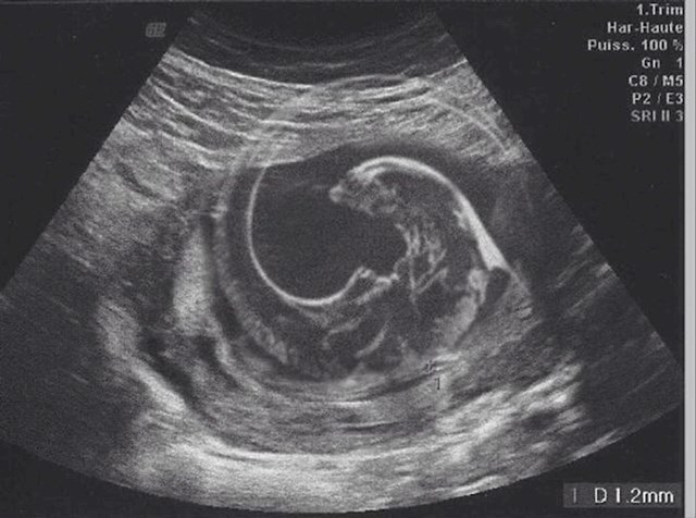 4. Zamijenio sam fotku naše bebe s ultrazvuka za malog aliena. Supruga nije niti skužila, poslala je to svim rođacima.😂