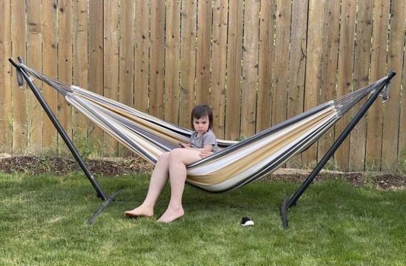 13. Djevojčica s nogama odrasle osobe