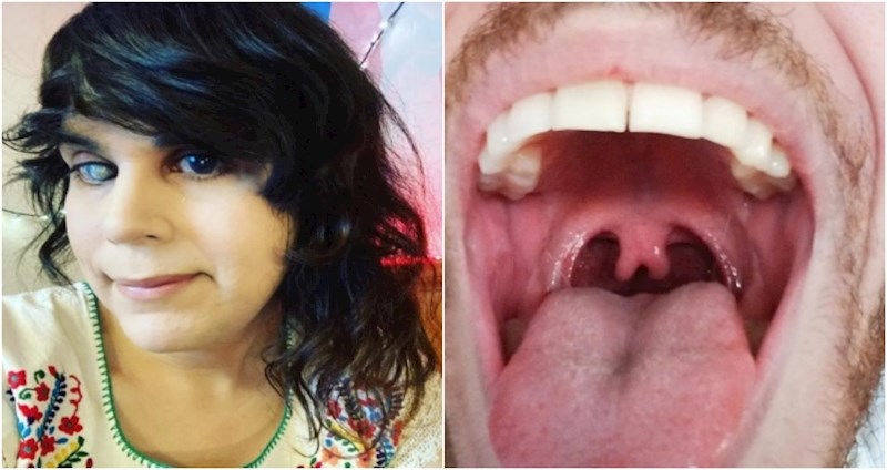 18 ljudi i životinja s ekstremno rijetkim fizičkim osobinama