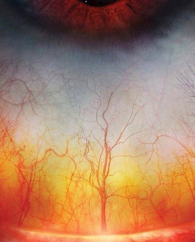 6. Ovaj krupni plan krvnih žila u ljudskom oku izgleda kao ukleta šuma.