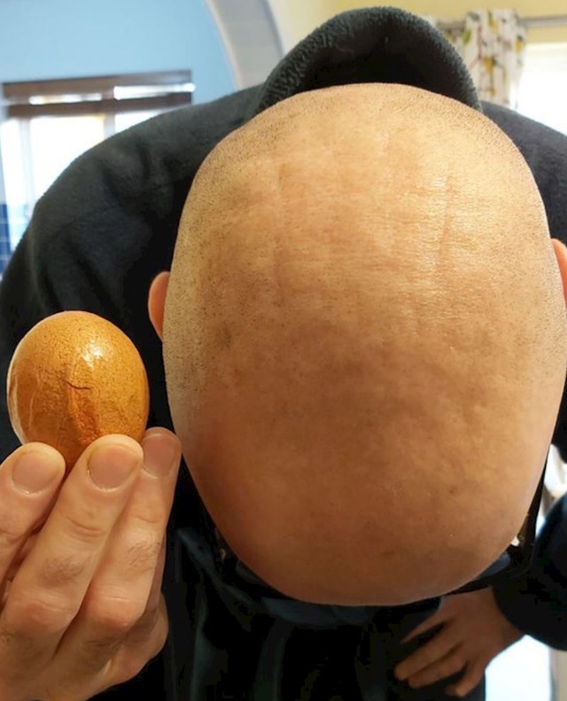 2. Njegova glava izgleda poput ovog jajeta🤣