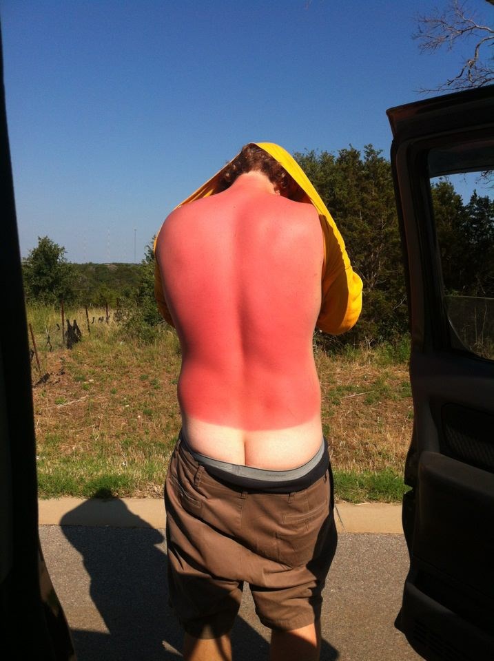 Pazi se sunčanja uz globalno zagrijavanje