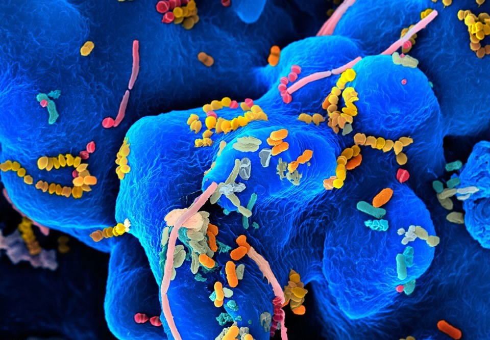 Ovo su mikrobi u vašim ustima