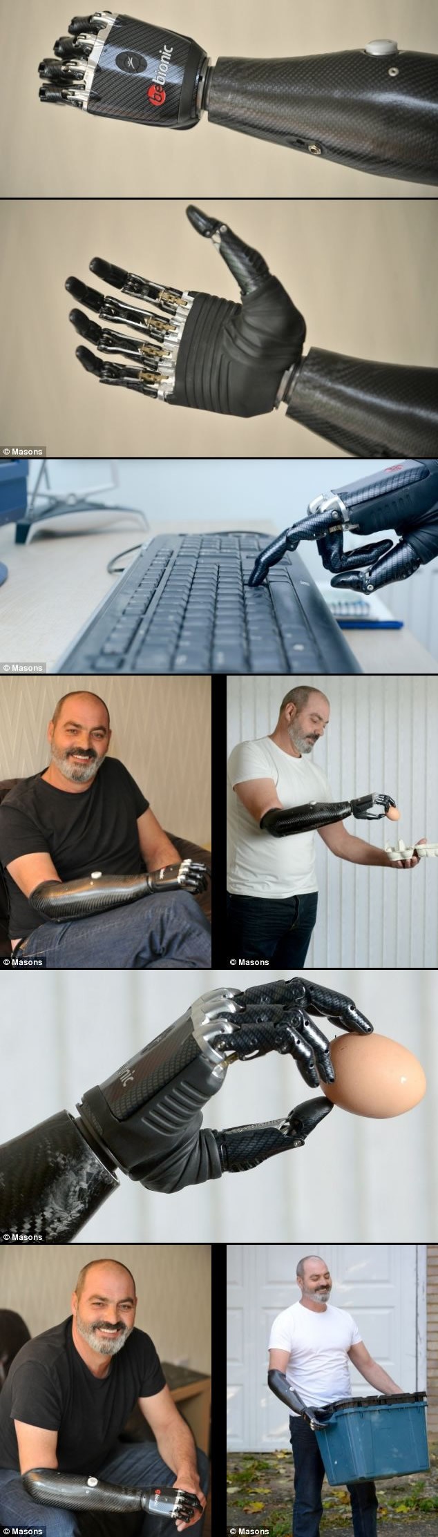 Budućnost je stigla - "terminator" dobio bioničku ruku