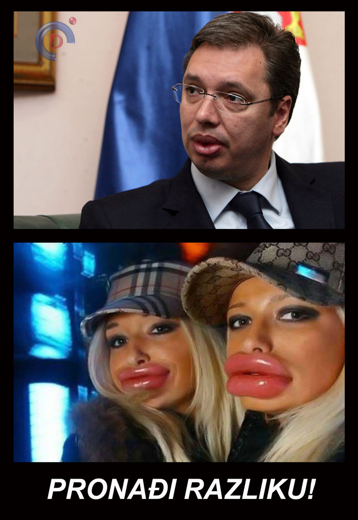 Razlika?
