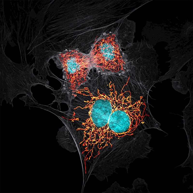#11Telofaza - posljednja faza mitoze
