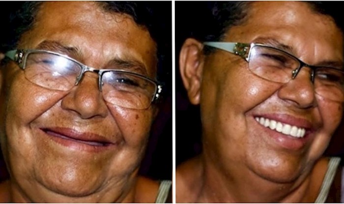 Ovaj brazilski zubar putuje kako bi popravio zube siromašnima; evo 18 prekrasnih transformacija