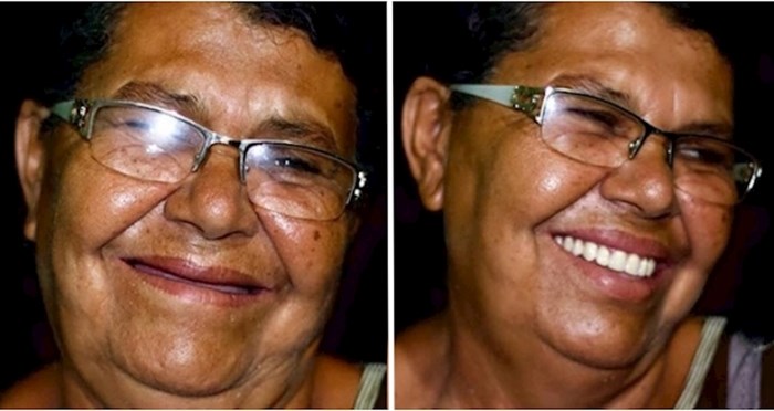 Ovaj brazilski zubar putuje kako bi popravio zube siromašnima; evo 18 prekrasnih transformacija