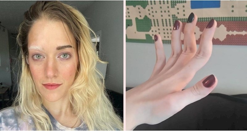 Nešto je posebno zanimljivo kod ovih ljudi, rođeni su drugačiji