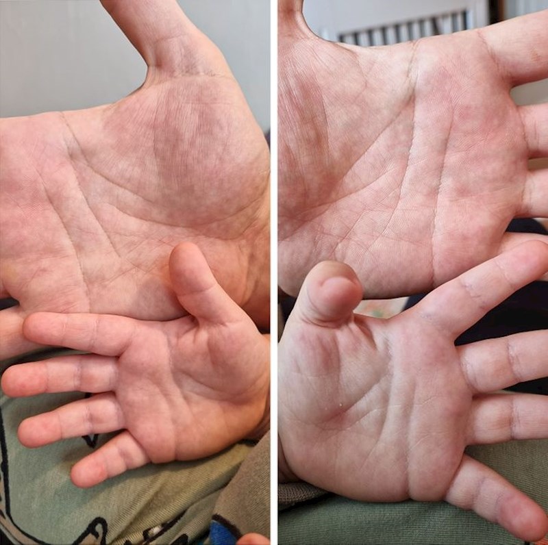 "Dlanovi moga sina i mene su gotovo identični.”