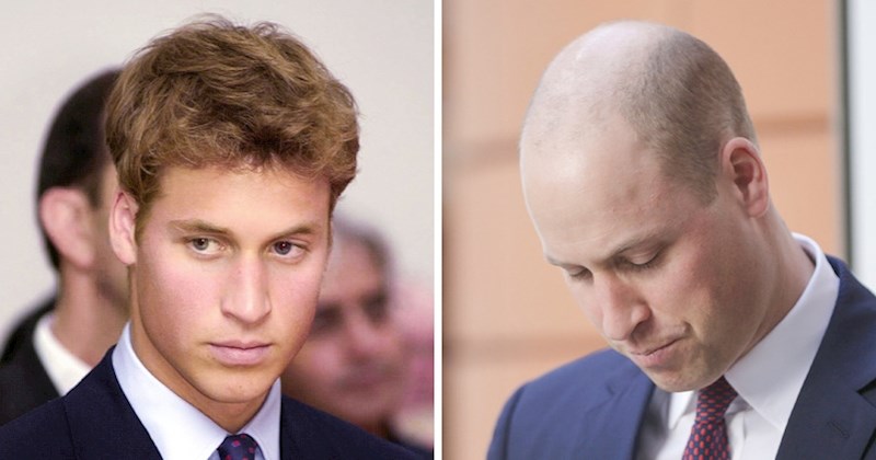 Ako izgubite više od 100 vlasi dnevno, nešto nije u redu.