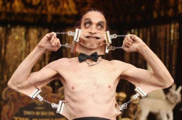 nije bolest sve što boli..:))