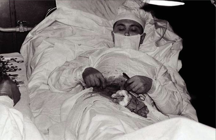 Dr. Leonid Rogozov izvodi operativni zahvat na sebi..Antarctica, 1961