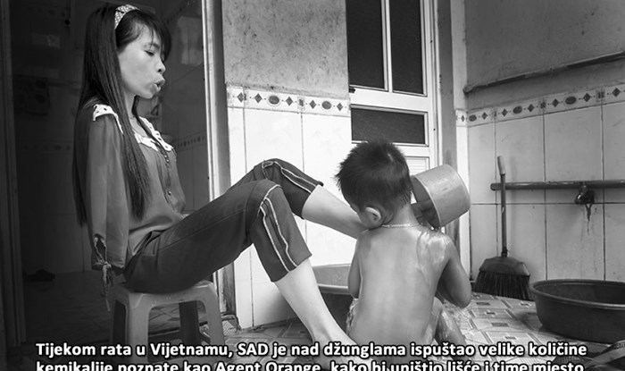 GALERIJA: Posljedice američkog genocida u Vijetnamu nisu porazile ovu hrabru djevojku!