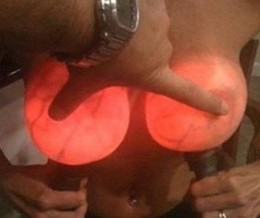 Prosvijetljene sise - šta se desi kad grud napadneš svjetlom