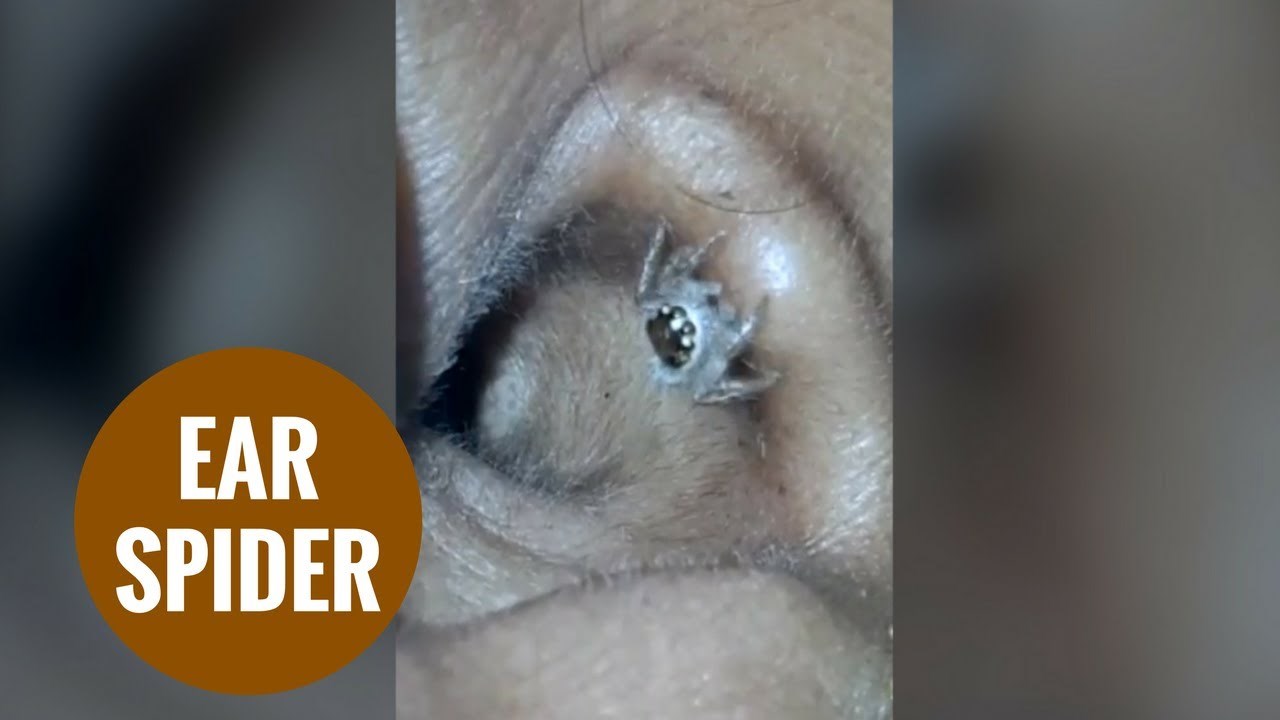 VIDEO Žena je imala bolove i čudan osjećaj u uhu, doktori su ostali šokirani kad su vidjeli što je unutra!