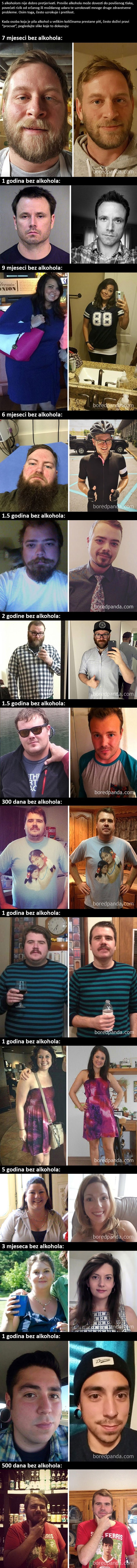 NEVJEROJATNA PROMJENA: Pogledajte kako ovi ljudi izgledaju sada kada su prestali piti alkohol!