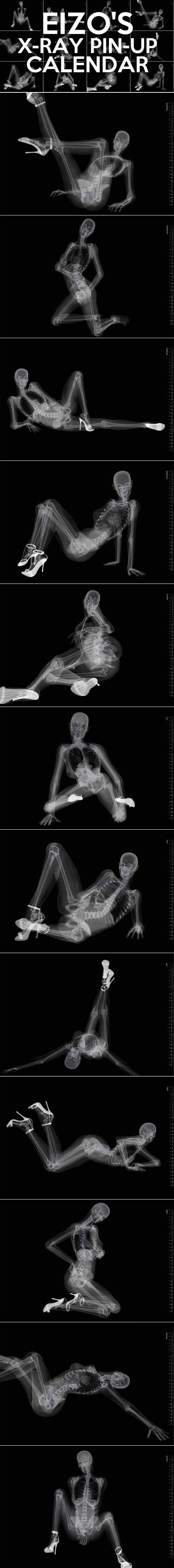 Rentgenski seksi kalendar: Malo si mi košćata, rebra ti vire