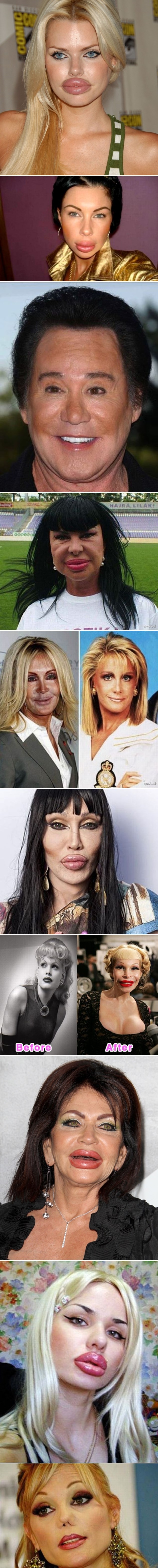 Galerija: Plastičarski ovisnici ne posustaju