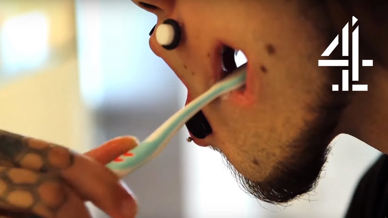 VIDEO Zbog svoje čudne strasti ima ogromne rupe po licu, otežano govori, a kada tek vidite kako pere zube...