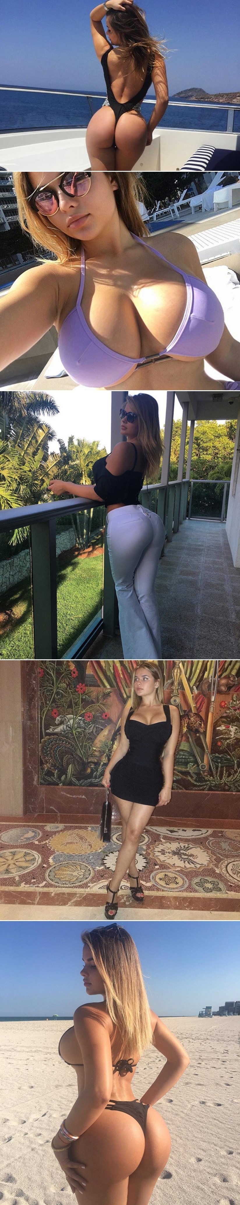 Dobila nogu jer je "predebela"