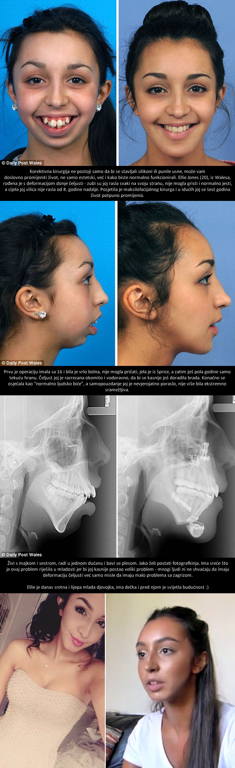 Rugali su joj se i zvali je "čudovištem", a onda je jedan kirurg odlučio RISKIRATI SVE!