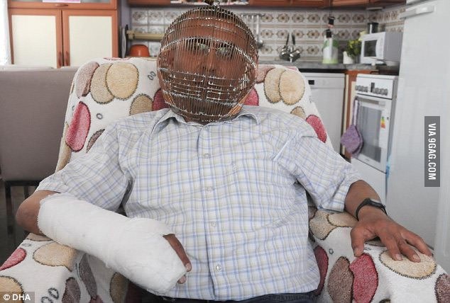 Grk si na glavu ugradio kavez kako bi prestao pušiti