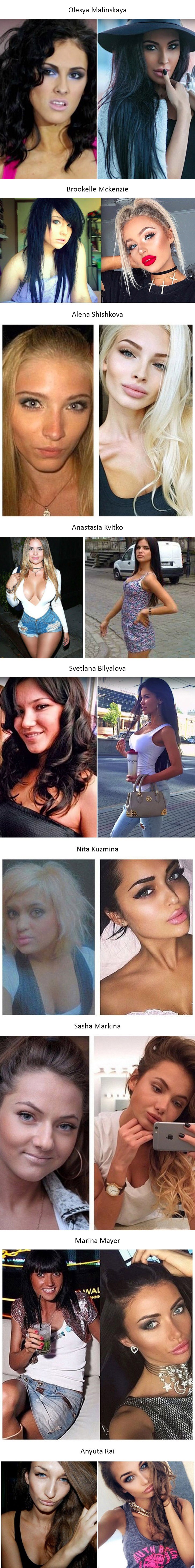 Stare fotografije poznatih Instagramovih ljepotica pokazuju kako su izgledale prije estetskih operacija