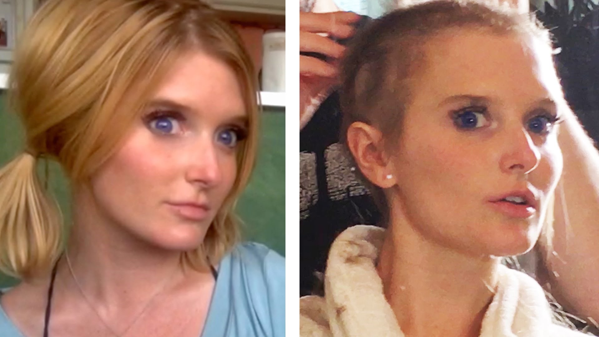 Zbog bolesti joj je kosa opadala, jednog dana je rekla DOSTA!