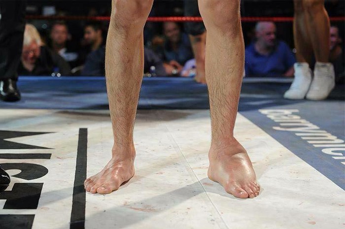 Stopalo MMA borca nakon mlaćenja