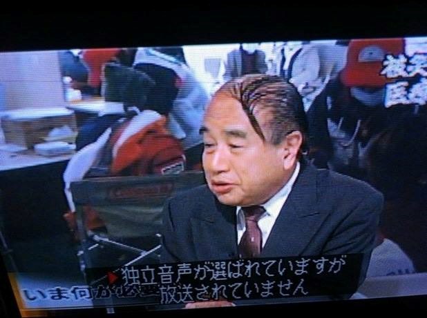 Dobro je, nitko neće skužiti ćelu