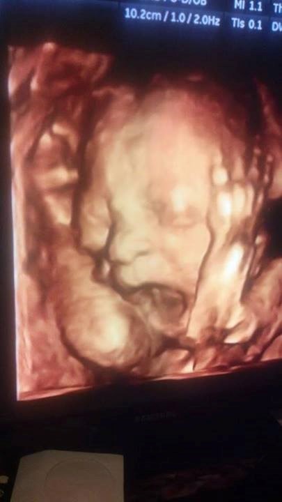 Beba doznala da će se roditi u Hrvatskoj