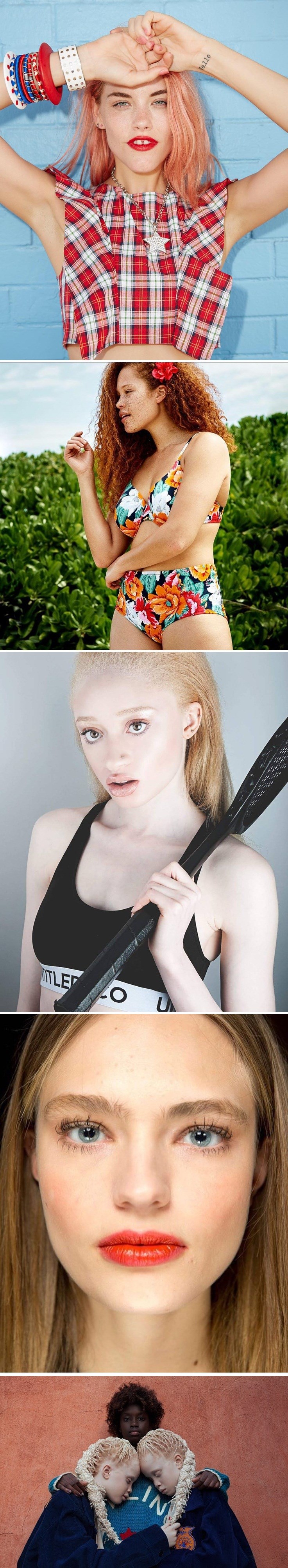 Upoznajte najneobičnije fotomodele i manekenke koje su dokazale ne moraš biti savršena kako bi bila posebna