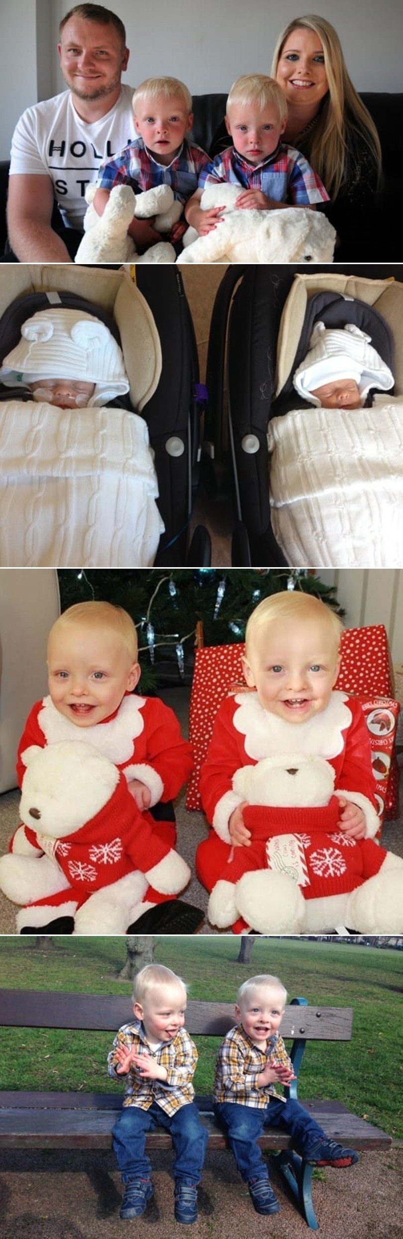 GALERIJA: Jednojajčani blizanci sa nevjerojatnom tajnom