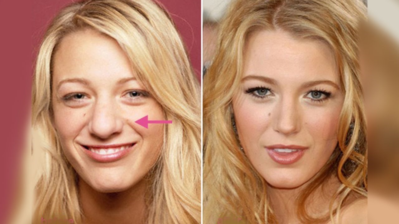 Ove su slavne žene operirale nos, a vi to sigurno niste znali!