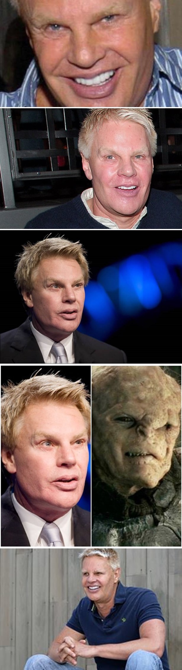 Čovjek koji mrzi debele ljude