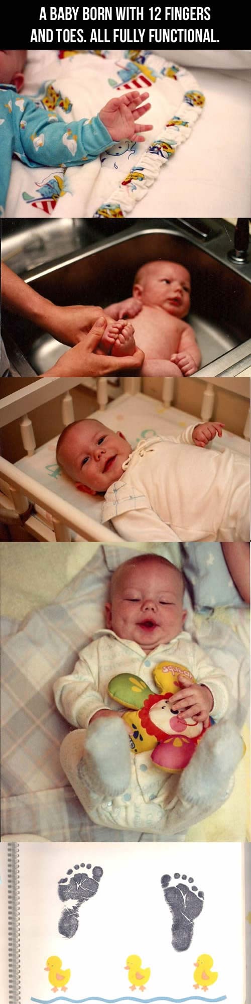 Bebač sa šest prstiju: Vesela beba s neobičnim bonusom